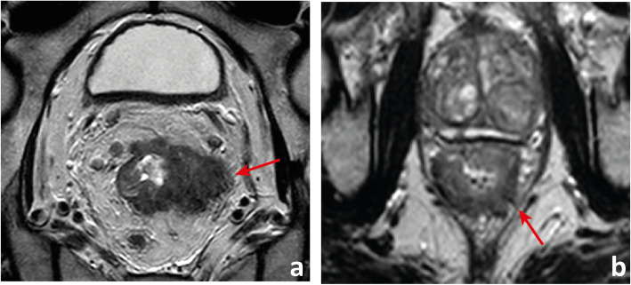 Fig. 13