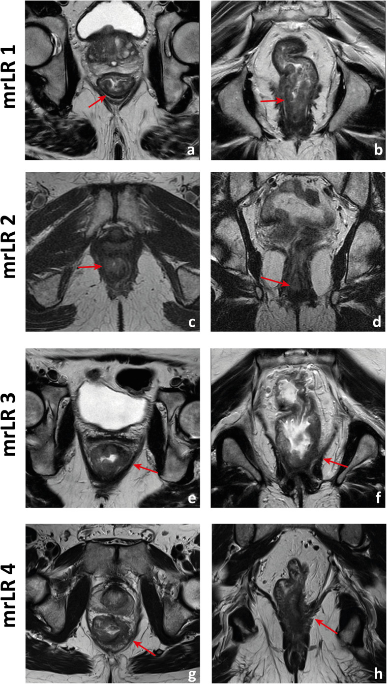 Fig. 20