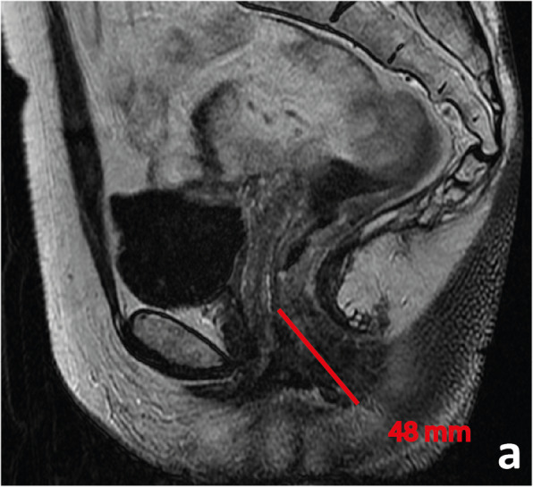 Fig. 19 