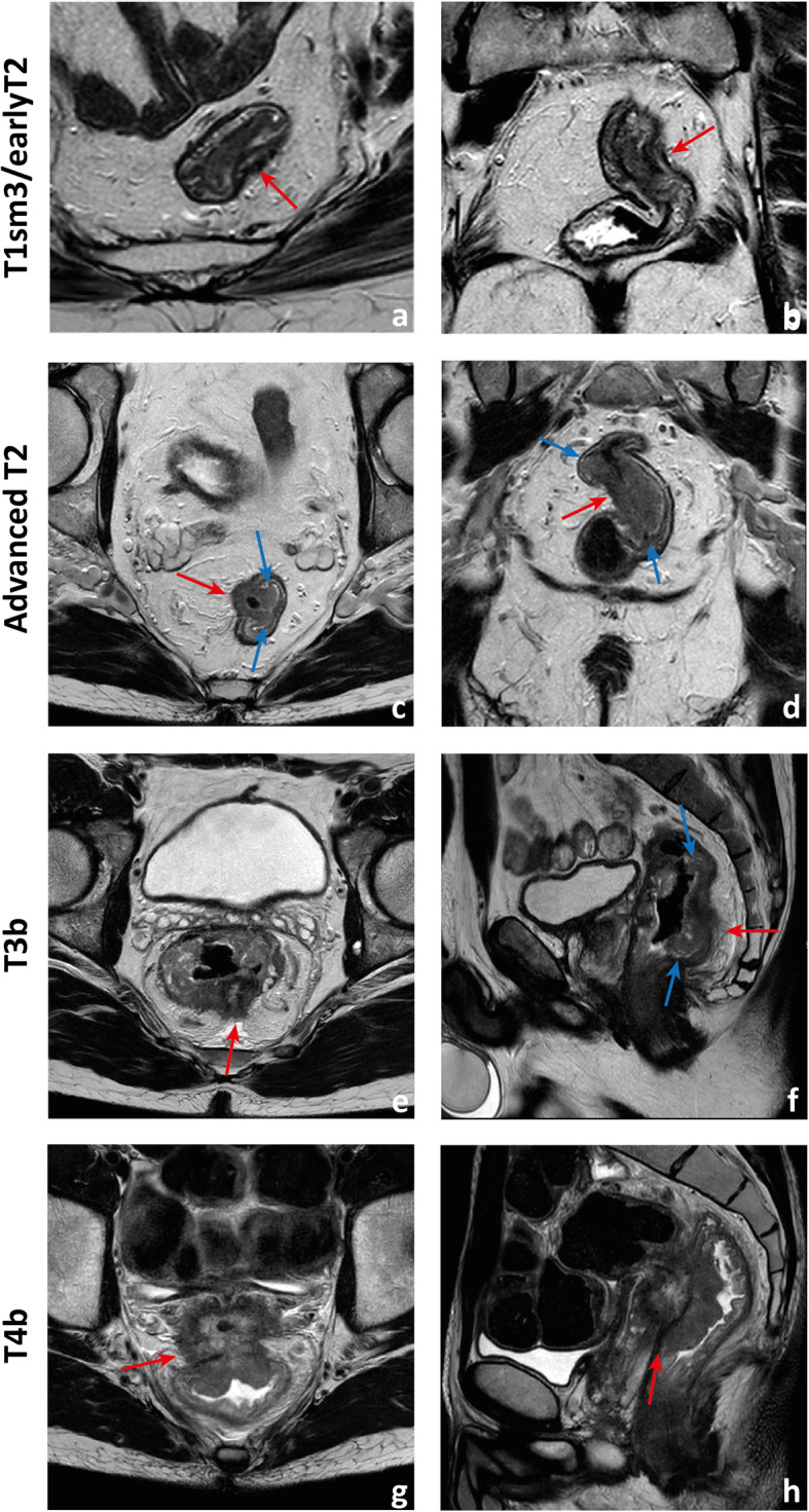 Fig. 12