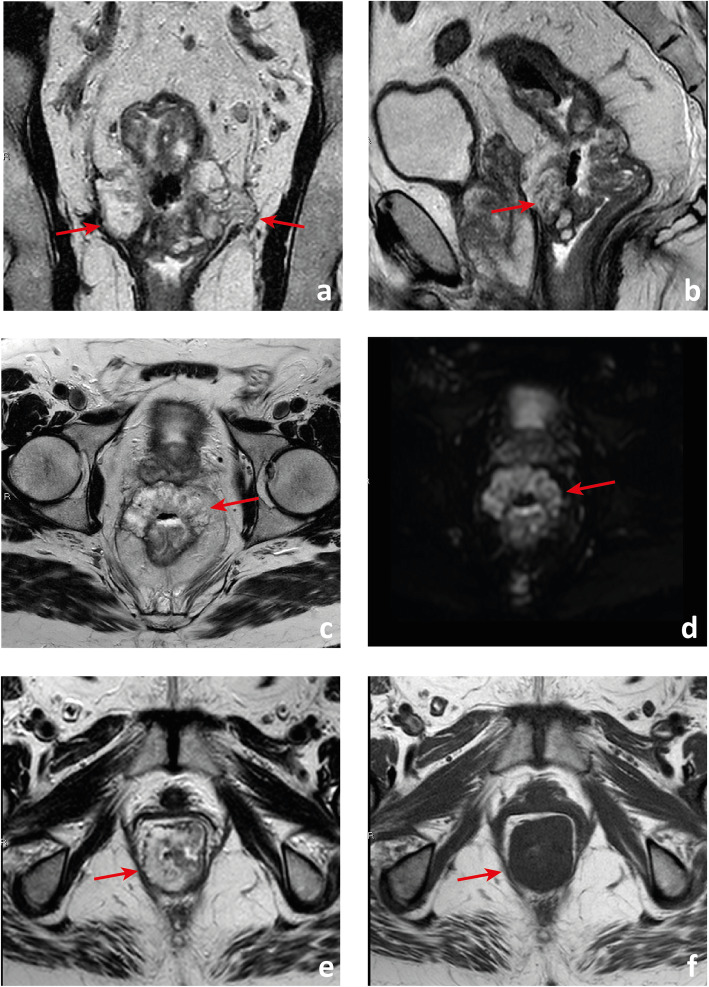 Fig. 21