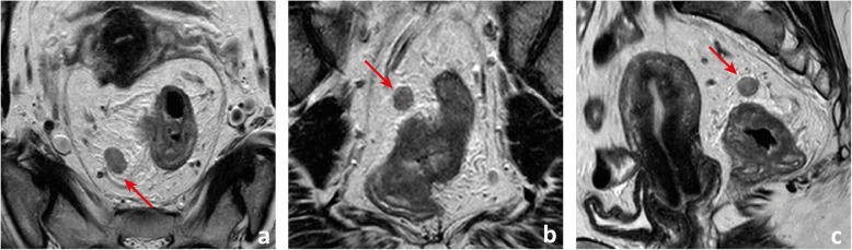 Fig. 10