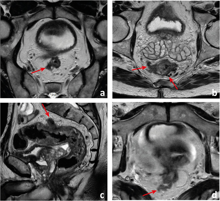 Fig. 14