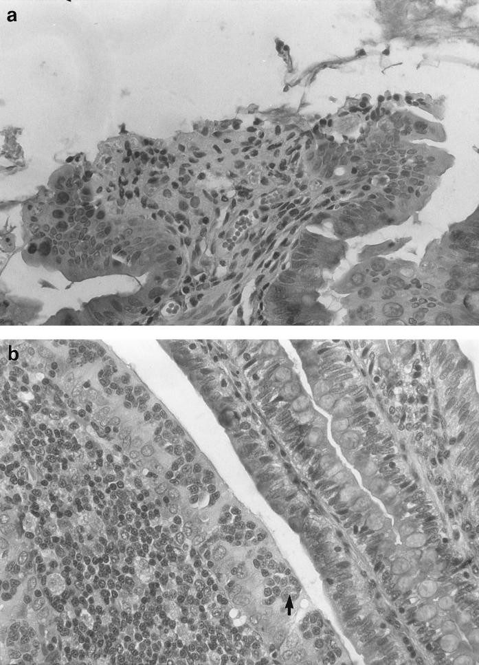 FIG. 6