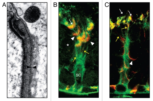 Spermiation: The process of sperm release - PMC