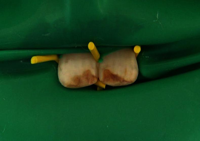 Figure 2