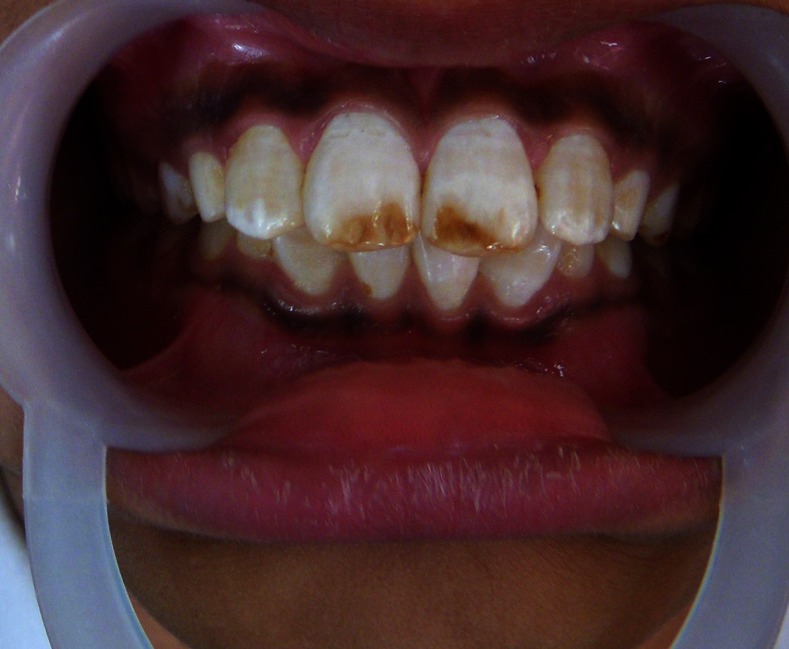 Figure 1