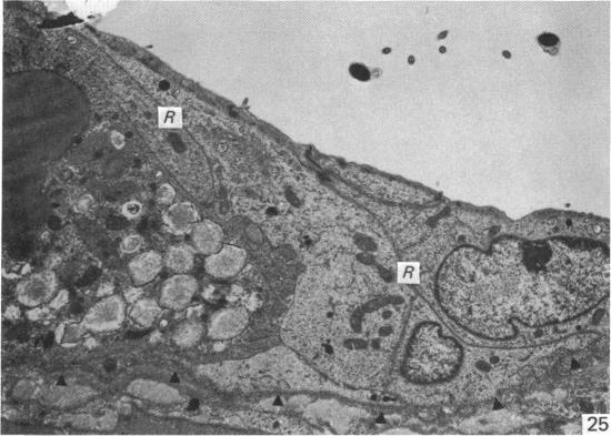 Fig. 25