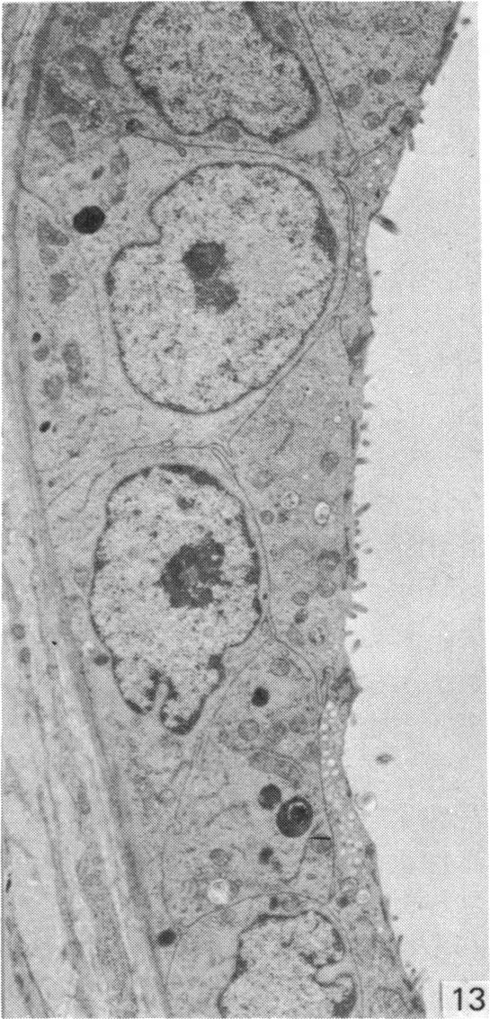 Fig. 13