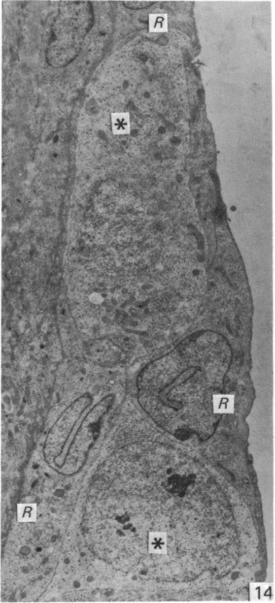 Fig. 14