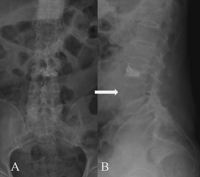 Fig. 1