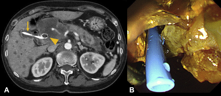 Figure 1