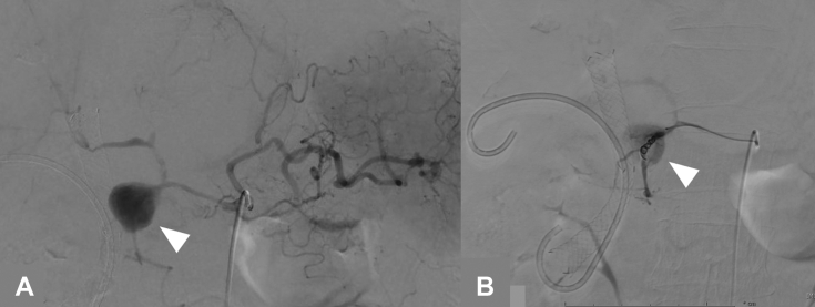 Figure 3