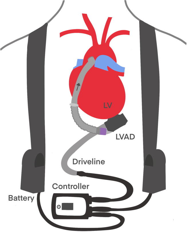 Fig. 1