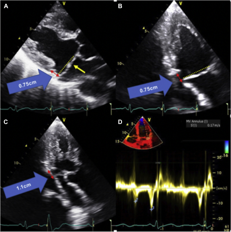 Figure 3