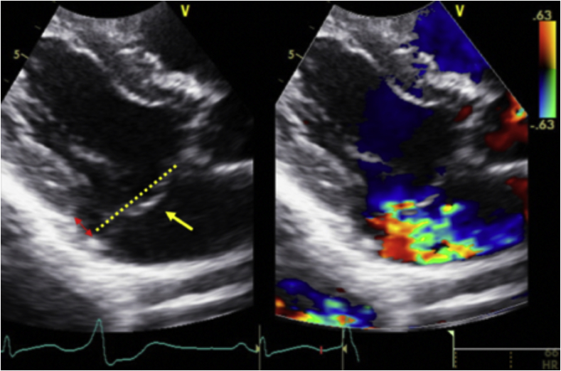 Figure 4