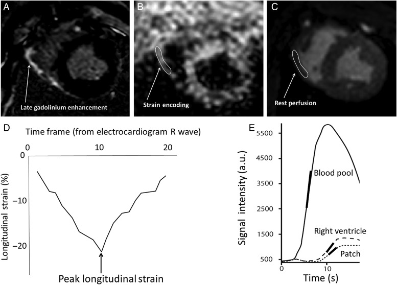 Figure 3: