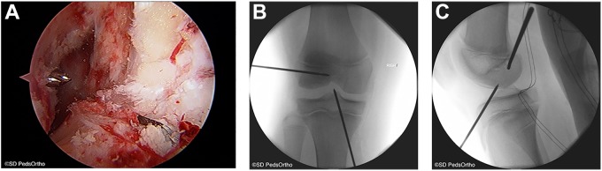 Figure 2.