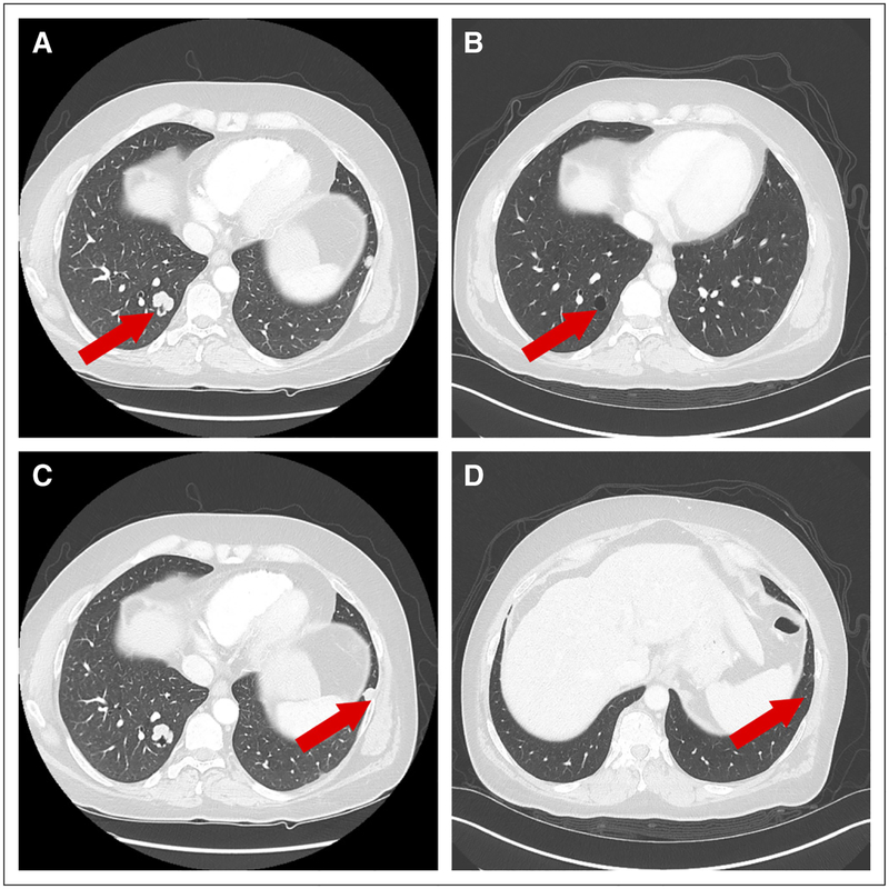 Fig 3.