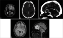 Figure 11: