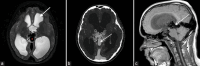 Figure 9: