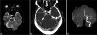 Figure 12: