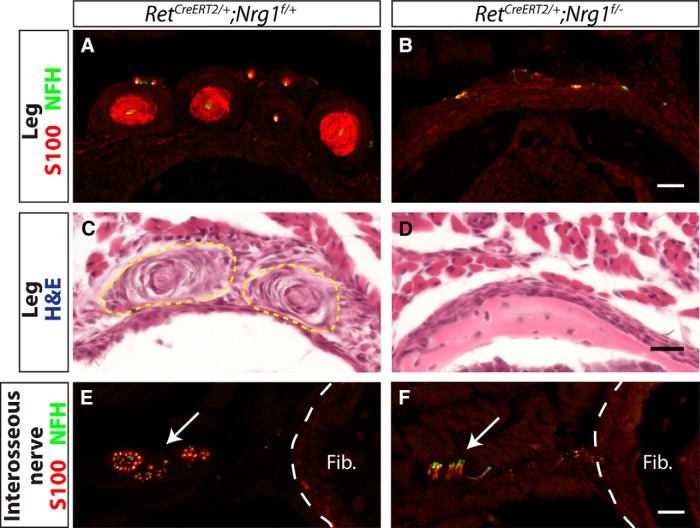 Figure 11.