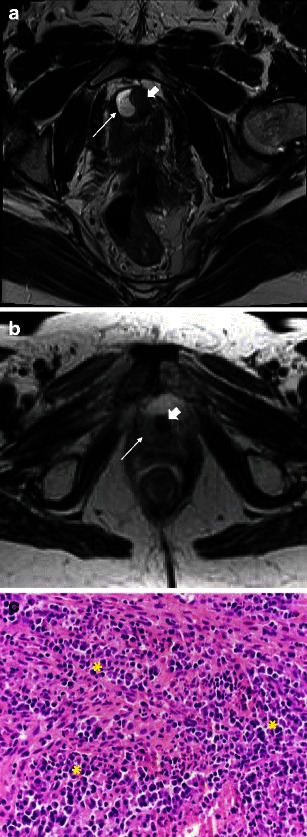 Fig. 11