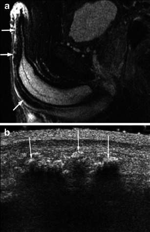 Fig. 13