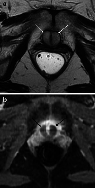 Fig. 12