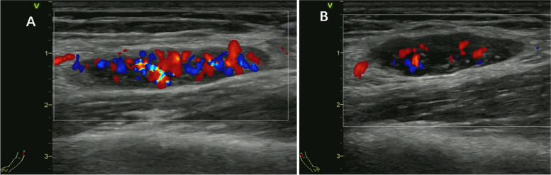 Fig. 5