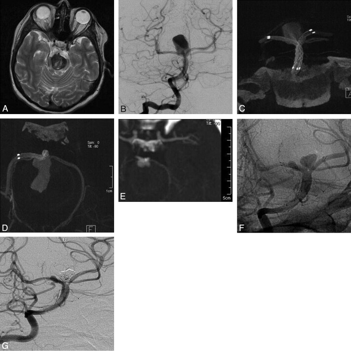 Fig 3.