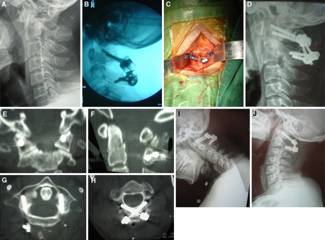 Fig. 1