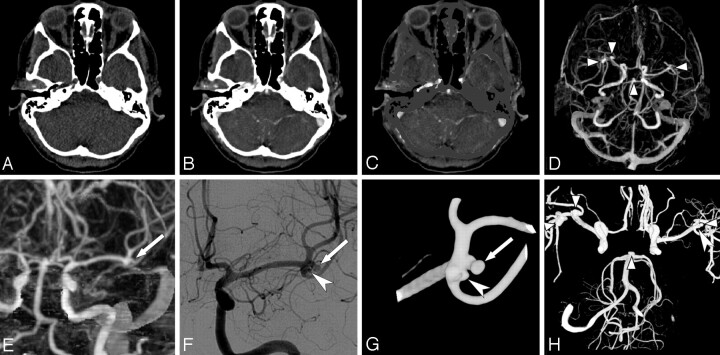 Fig 1.