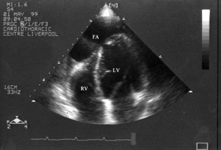 Figure 2  