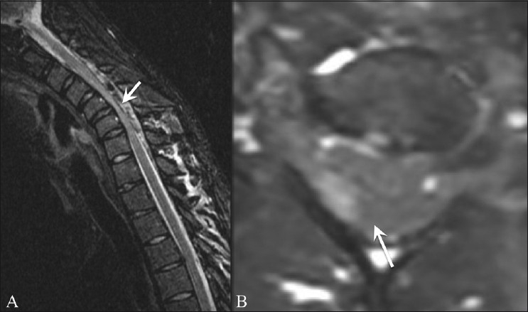 Figure 4 (A, B)