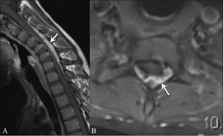 Figure 3 (A, B)