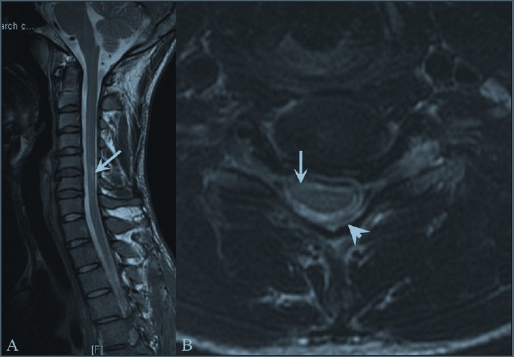 Figure 1 (A, B)