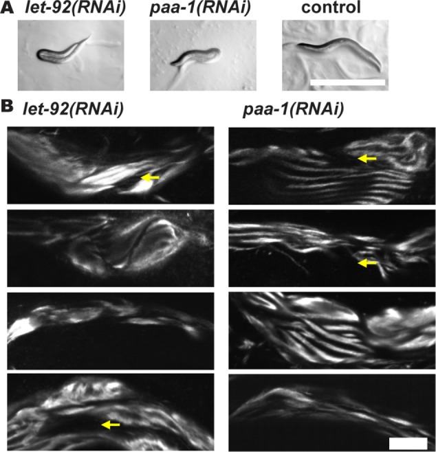 FIGURE 11: