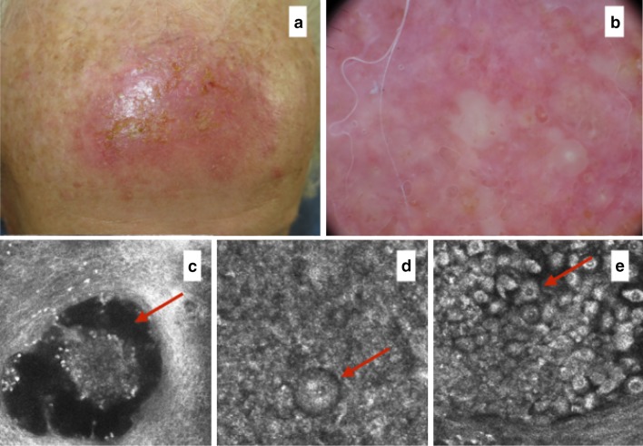 Fig. 4