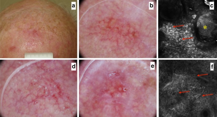 Fig. 3