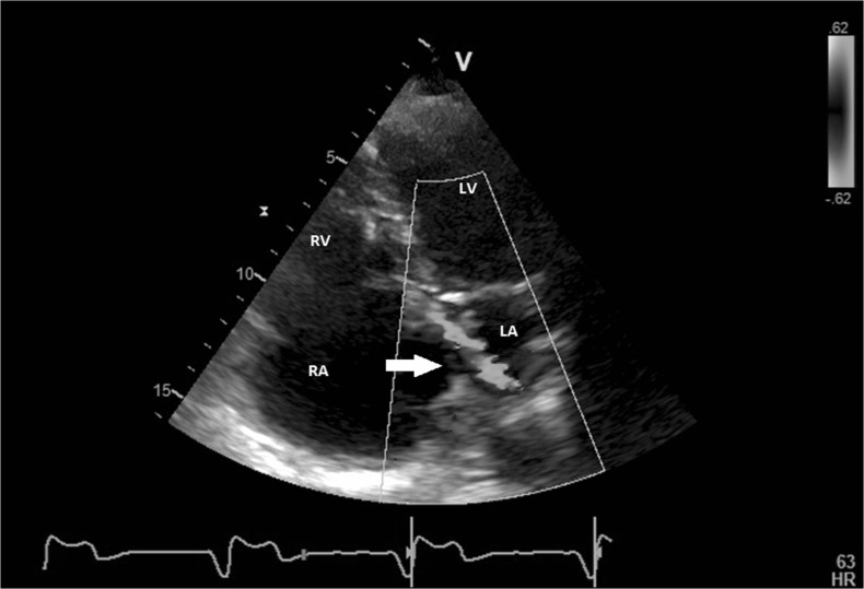 Fig. 4