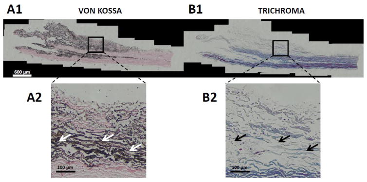 Fig. 12