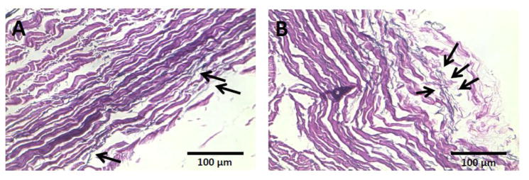 Fig. 11