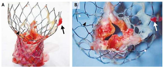 Fig. 13