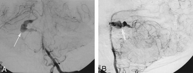 Fig 2.