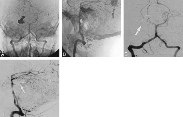 Fig 3.