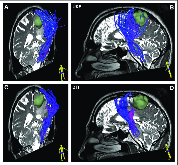 FIG 3.