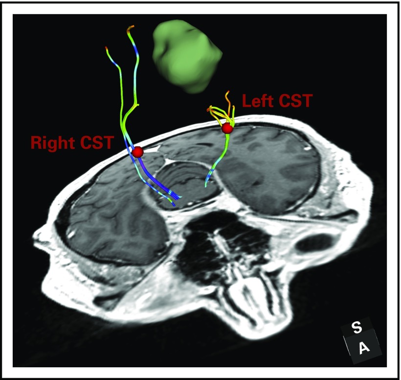 FIG 2.