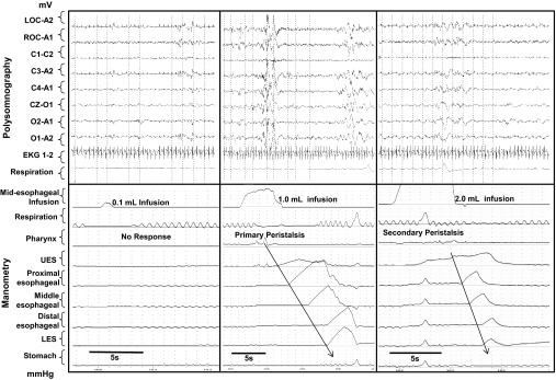 Fig. 2.